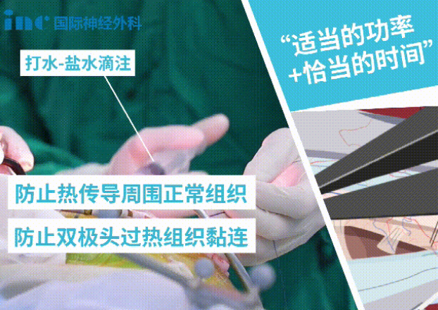 雙較電凝是如何達(dá)到止血效果呢？