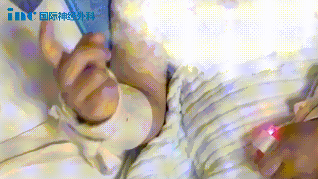 3歲，體重僅16kg，較大腦干占位