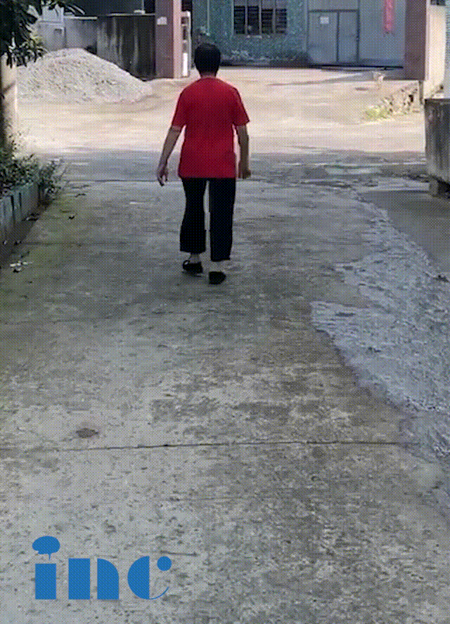 三個(gè)月，在術(shù)后常規(guī)隨訪中，我們看到視頻中的她已經(jīng)可以正常走路行動，語言表達(dá)正常。