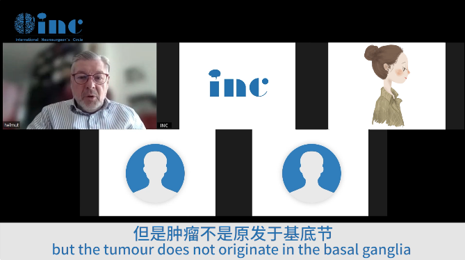 巴教授從腫瘤生長方式和手術中即將采用的入路，生動詳細得為患兒家屬解釋著手術方案。