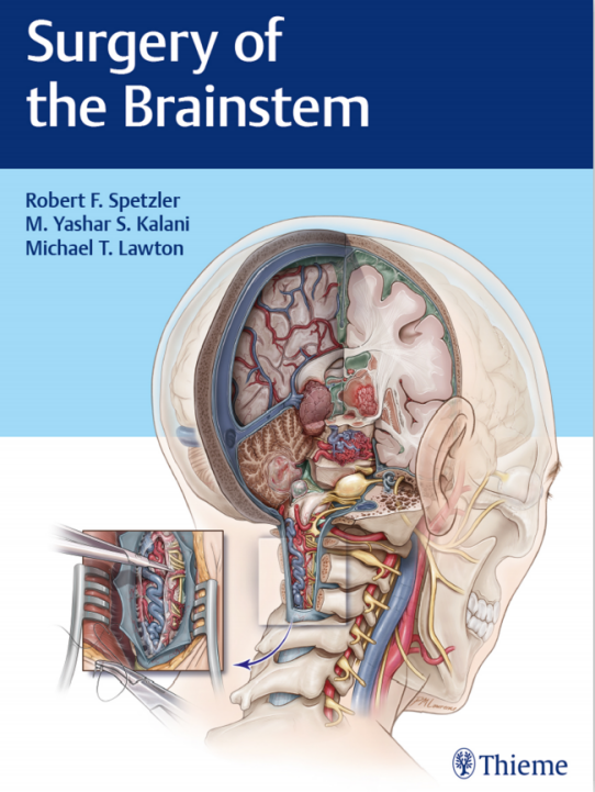 世界腦干手術(shù)專著《Surgery of the Brainstem》