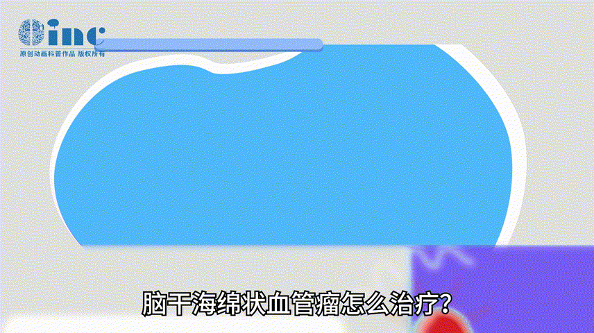 腦干海綿狀血管瘤怎么治療？