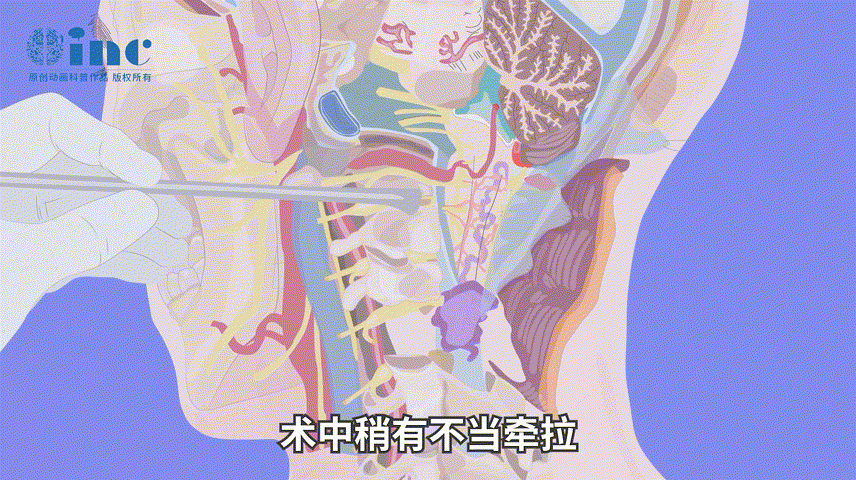 脊髓腫瘤手術(shù)