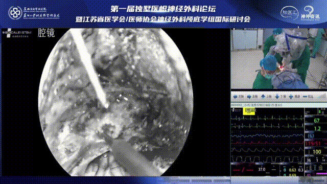從寰椎后弓側(cè)方進(jìn)行解剖時(shí)要仔細(xì)，采用低功率燒灼參數(shù)，手術(shù)操作要仔細(xì)，避免造成動(dòng)脈損傷及刺破硬腦膜或在分離肌肉時(shí)損傷椎動(dòng)脈。