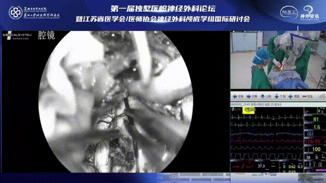 鏡下可見(jiàn)海綿狀血管瘤浸潤(rùn)突破延髓表面征象，從此處“突破口”作為脊髓表面切口，按序逐步分離腫瘤和腦組織。