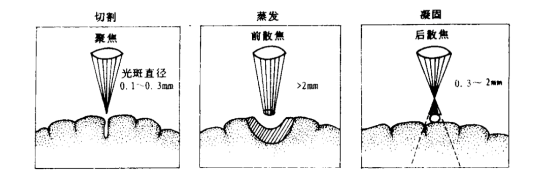 激光對腦組織的熱效應(yīng)