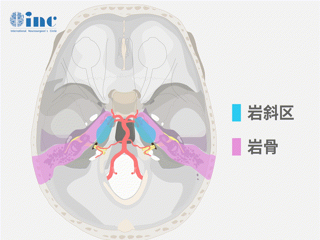 巖斜坡區(qū)占位是顱底手術(shù)中極為復(fù)雜的疾病之一，與關(guān)鍵的神經(jīng)血管結(jié)構(gòu)和腦干密切相關(guān)。