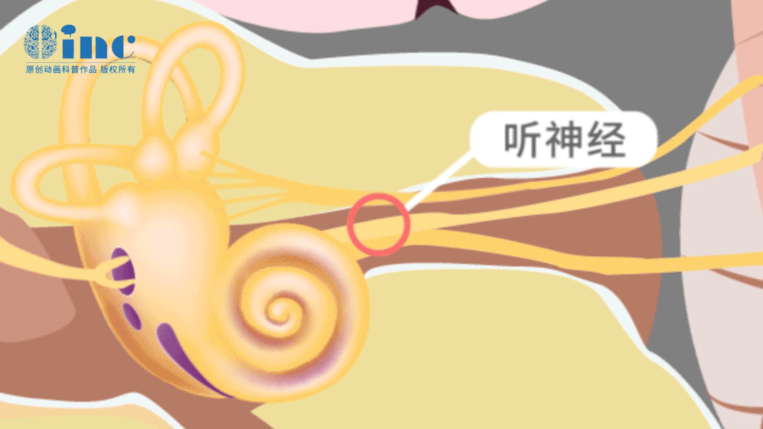 從治療策略上來說，手術(shù)是已出現(xiàn)癥狀的聽神經(jīng)瘤治療的首要標(biāo)準(zhǔn)。