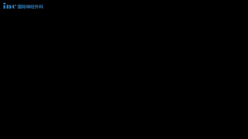 巴教授護(hù)航小患者突破生命禁區(qū)：兒童疑難腦瘤示范手術(shù)紀(jì)實(shí)